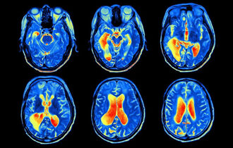 Виды контраста в МРТ, КТ и рентгенографии