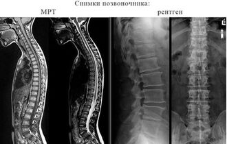 Рентгенография, КТ и МРТ: в чем отличие?